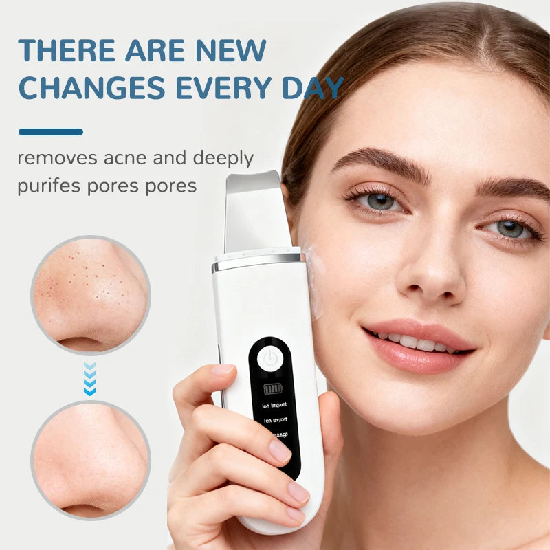 Ultrasonic Facial Cleansing Device for Blackhead Removal