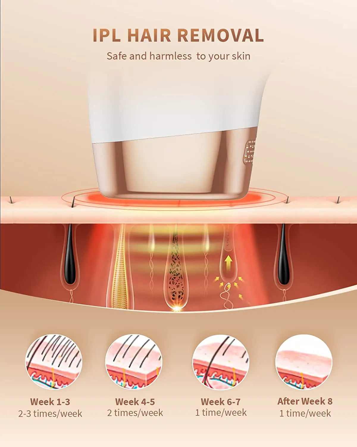 Wireless IPL Laser Hair Removal Device