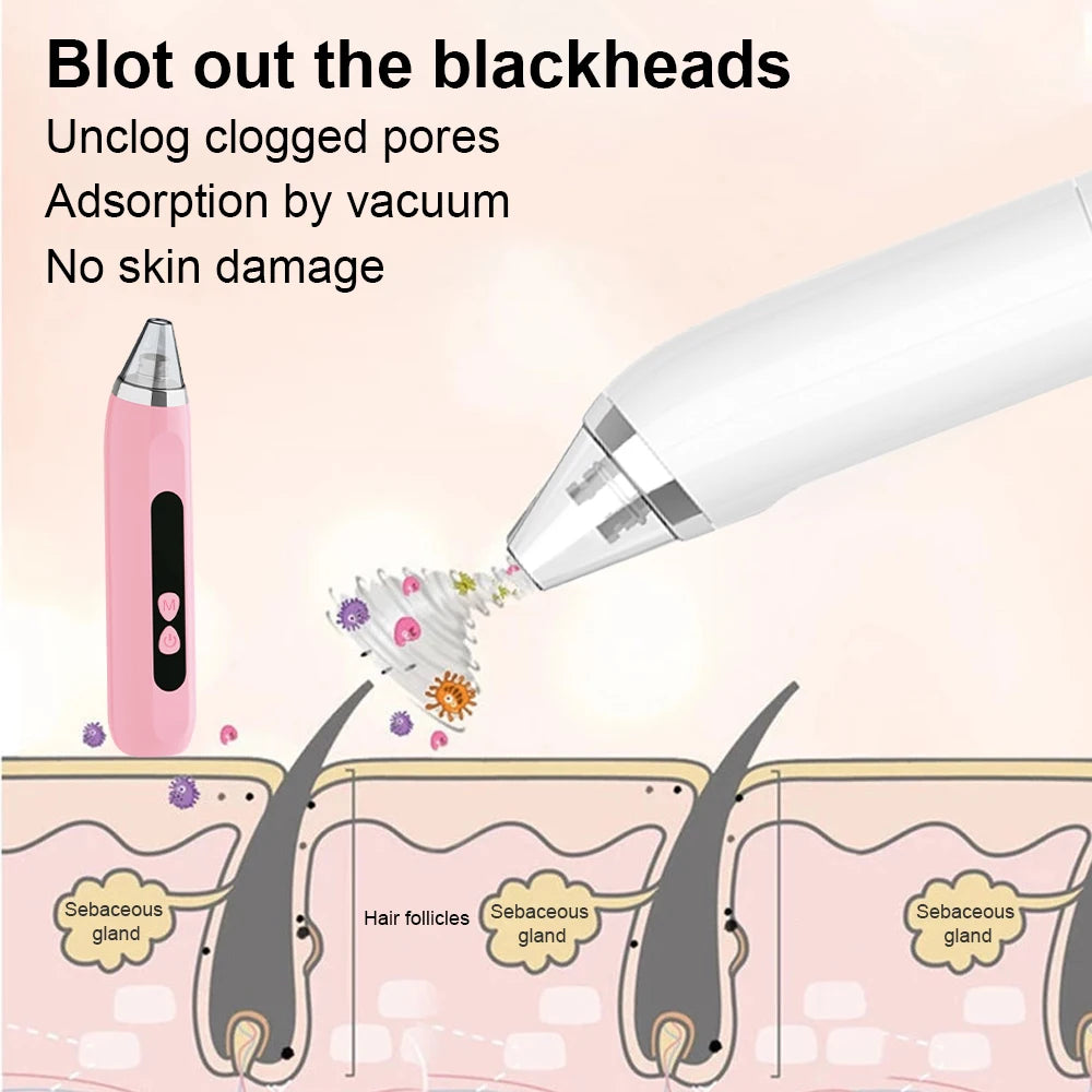 Facial and Nasal Pore Cleaner — Vacuum Blackhead Remover