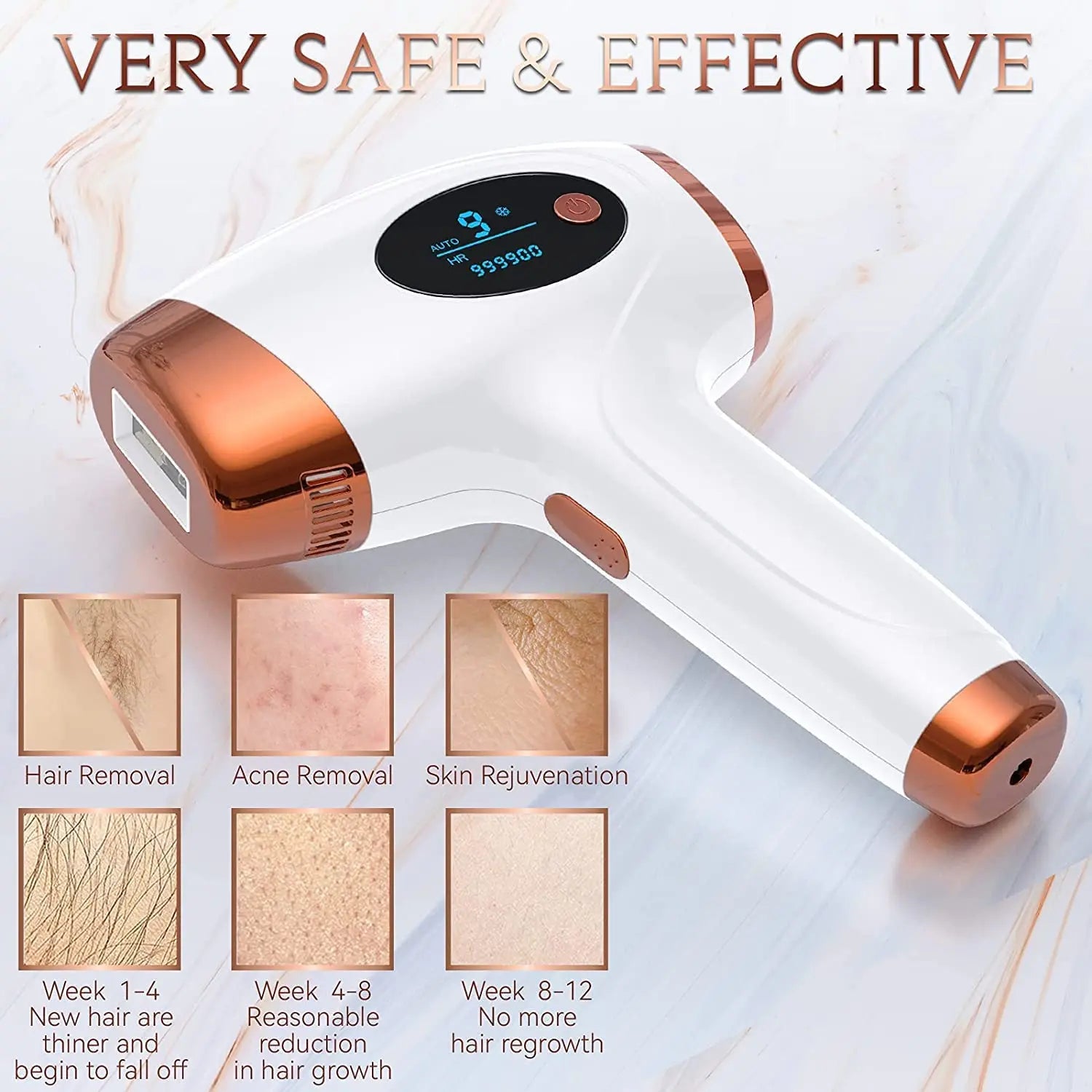 Wireless IPL Laser Hair Removal Device
