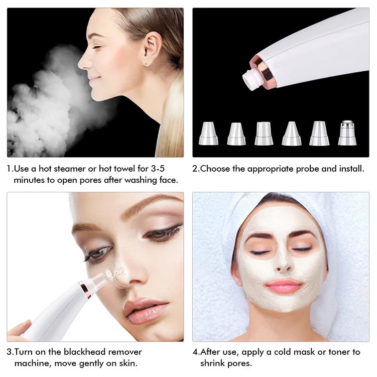 Electric Blackhead Remover Pore Vacuum